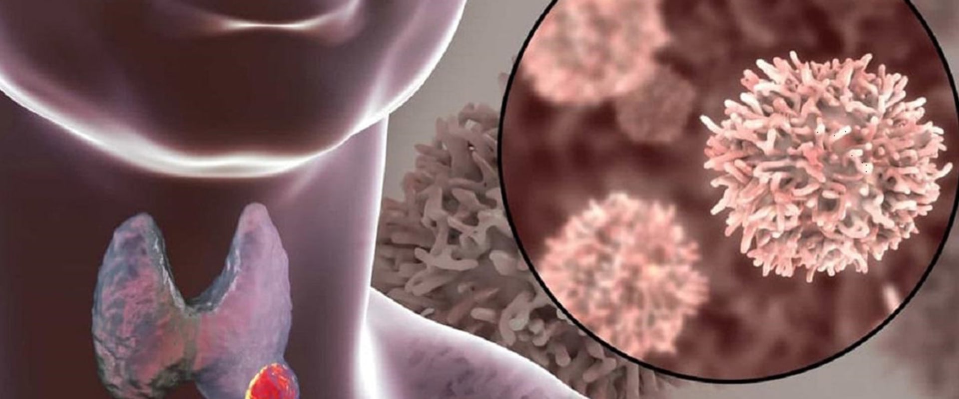 Understanding the Impact of Iodine Deficiency on Thyroid Health and the Benefits of Iodine Supplements