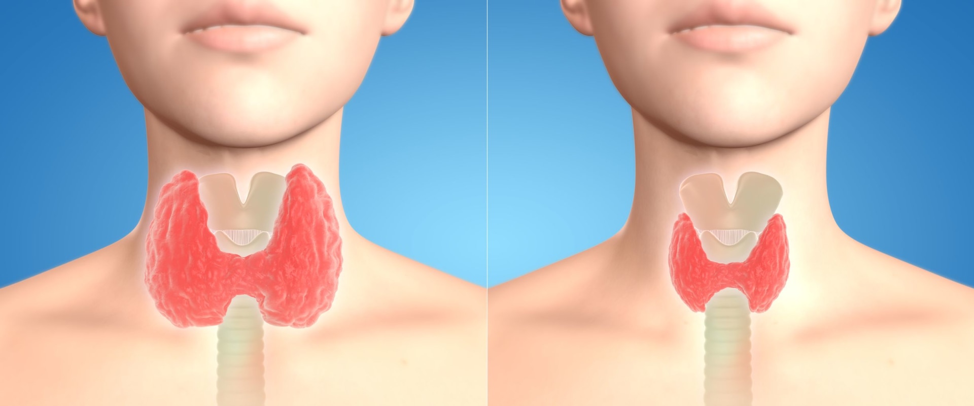 Understanding the Impact of Low Iodine on Your Health and the Benefits of Iodine Supplements